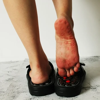 Acupoint Papuci De Masaj Pentru Barbati Femei Sandale Picioare Chineză Presopunctura, Terapia Medicală Rotative De Masaj Pentru Picioare Pantofi Unisex